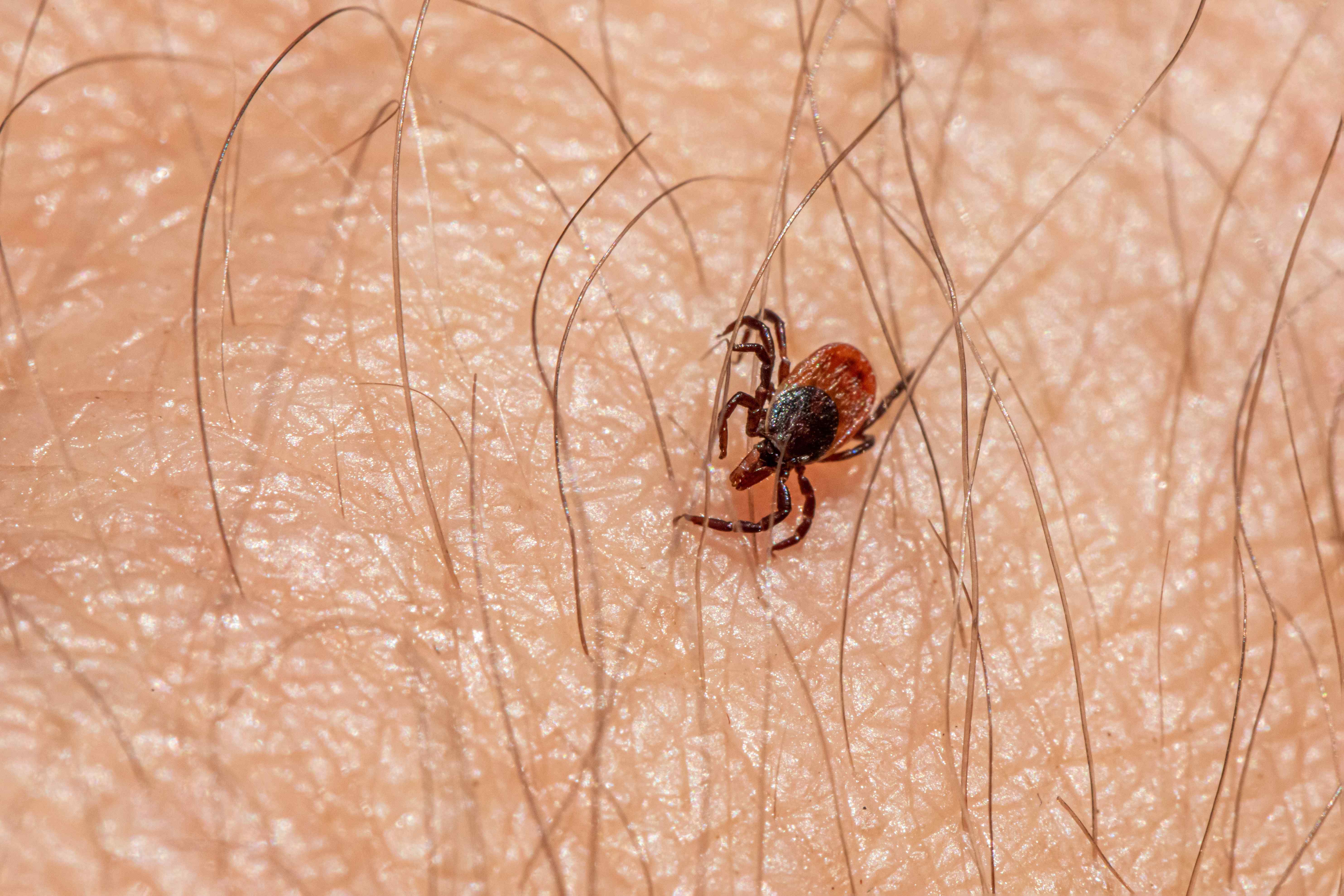 Can Lyme Disease Cause Autism?